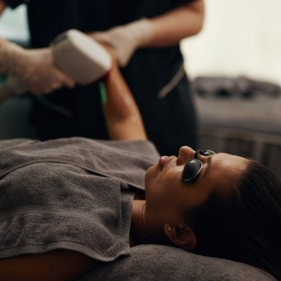 Hand Rejuvenation (IPL + Laser)